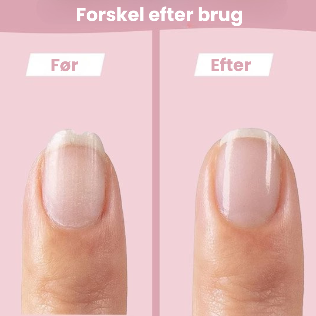 SafeCare – Støjfri og sikker – Elektrisk neglefil til babyer