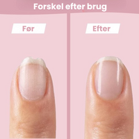 Thumbnail for SafeCare – Støjfri og sikker – Elektrisk neglefil til babyer